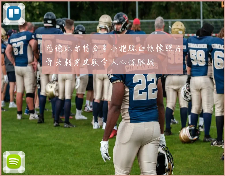 范德比尔特分享小指脱臼惊悚照片骨头刺穿皮肤令人心惊胆战